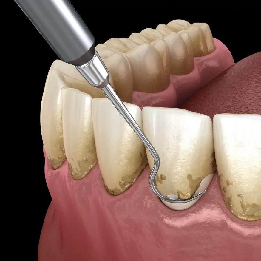 Servicios Odontológicos Especializados